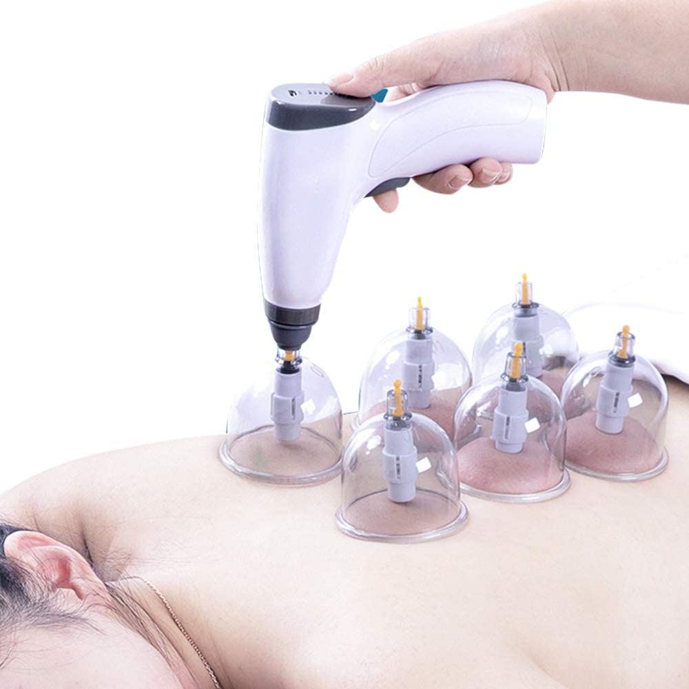 Set bekam vakum elektrik 24/4  - Cupping Therapy Set ulasan dan harga